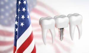 Freedom From Dentures: Celebrate Independence Day With Dental Implants