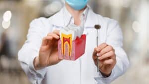 Root Canal treatment Saves Tooth