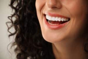 porcelain-veneers-in-Oak-Park
