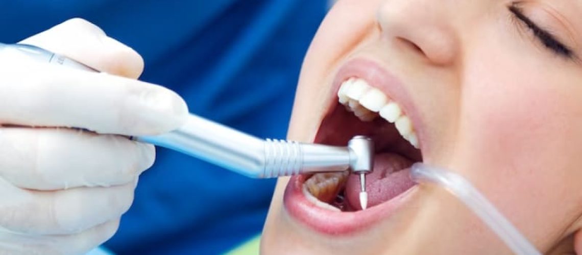5 Tips for Maintaining Strong and Healthy Dental Fillings
