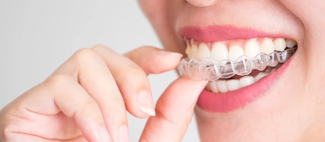 How Invisalign Can Improve Your Oral Health?