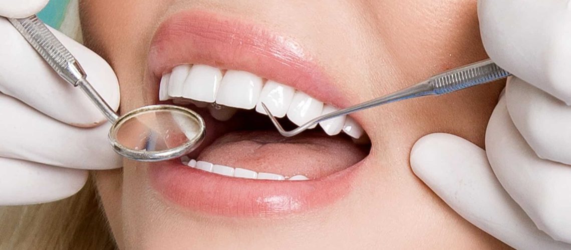 Where can I get Veneers Oak Park?