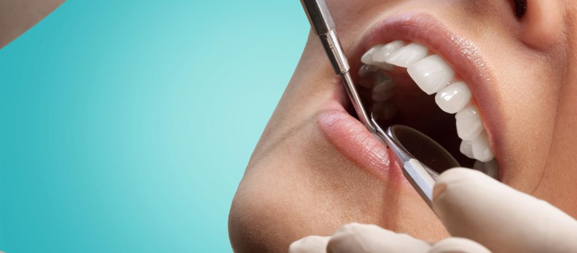 dentist checking mouth
