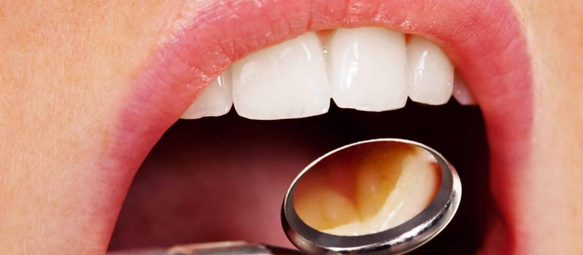 where is the best oak park dentist?