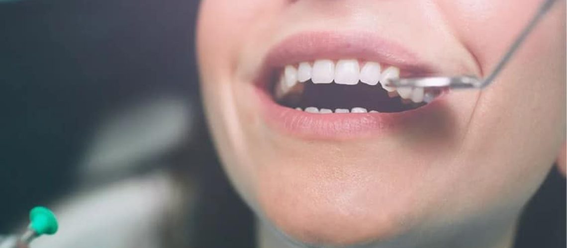 Emergency Dentistry: How to Handle a Broken or Loose Crown