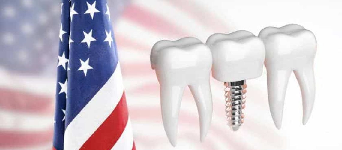 Freedom From Dentures: Celebrate Independence Day With Dental Implants