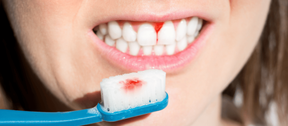 Periodontal 4