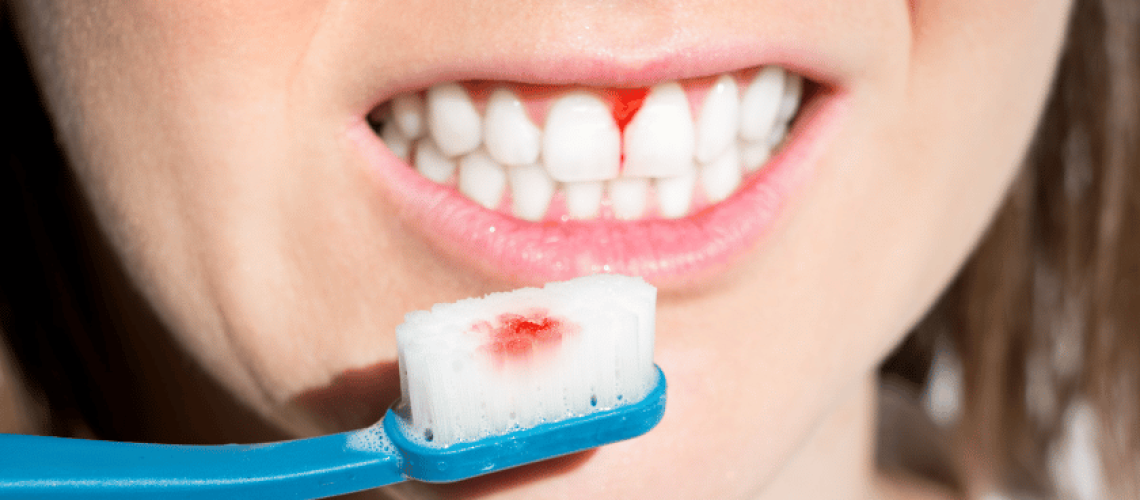 Periodontal 4