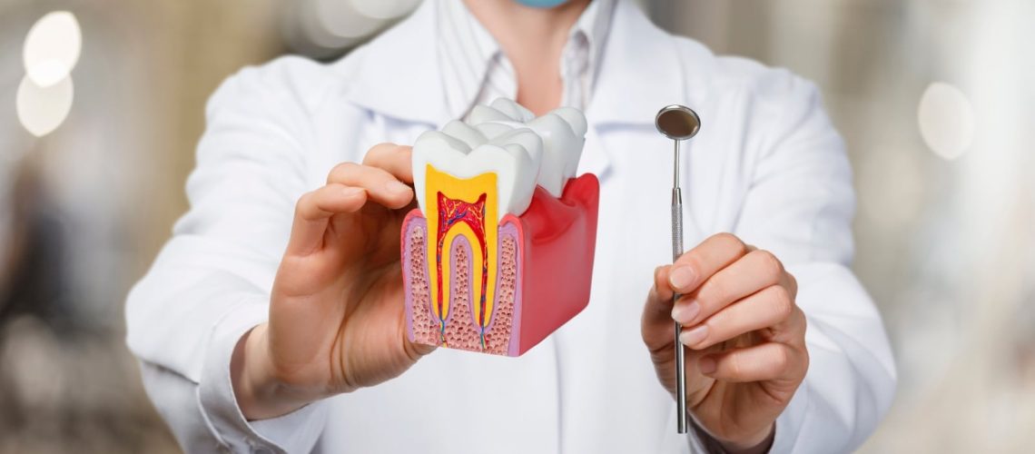 Root Canal treatment Saves Tooth