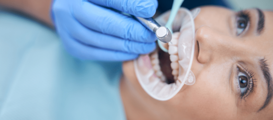 Signs You Might Need a Dental Filling- What to Look Out For