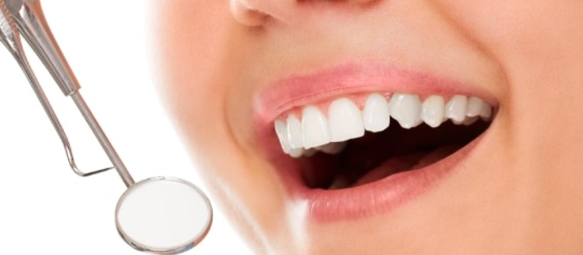 Teeth Whitening in Oak Park