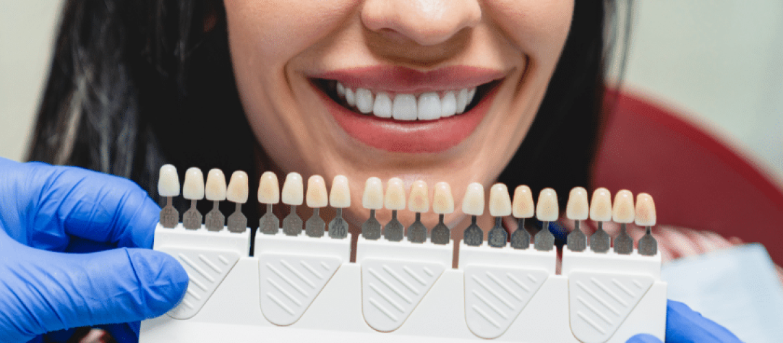 Transform Your Smile with Veneers- Fix Chips, Gaps, Discoloration