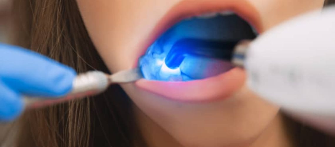 Restorative Dentistry in One Fine Smile - Dentist in Oak Park